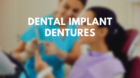 Dental Implant Dentures fhgh